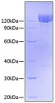 Recombinant Mouse PDGFRA/PDGF R alpha/CD140a Protein (RP00718)