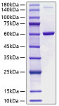 Recombinant Human Visfatin/Nampt Protein (RP00724)