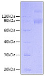Recombinant Mouse IL-1 R1/IL-1 RI Protein (RP00728)