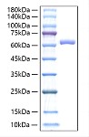 Recombinant Mouse IL-27/IL-27A&IL-27B Protein (RP00772)