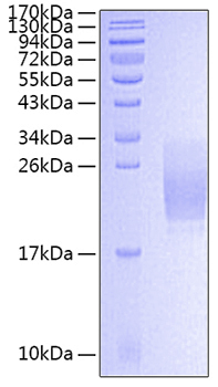 Recombinant Human Alpha-2-macroglobulin/A2M Protein