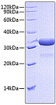 Recombinant Mouse IGFBP-7 Protein (RP00790)