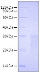 Recombinant Human TMIGD2/CD28H Protein (RP00809)