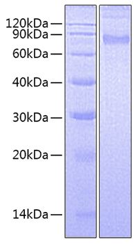 Recombinant Human CCL11/Eotaxin Protein