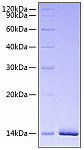 Recombinant Human Estrogen receptor/ESR1 Protein (RP00815)