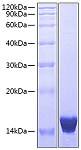 Recombinant Human IL-17F Protein (RP00824)