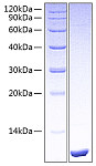 Recombinant Human LR3-IGF-1 Protein (RP00825)