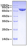Recombinant Human MMP-2 Protein (RP00840)