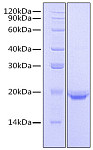 Recombinant Human IL-17F Protein (RP00870)