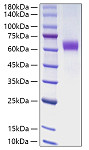 Recombinant Human Jagged1/JAG1/CD339 Protein (RP00877)