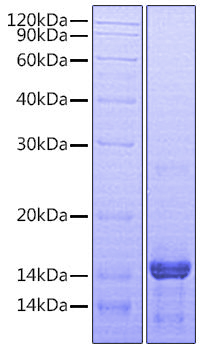 Recombinant Human Amphiregulin/AREG/AREGB/CRDGF/SDGF/AR Protein