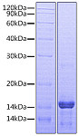 Recombinant Human Amphiregulin/AREG/AREGB/CRDGF/SDGF/AR Protein (RP00898)
