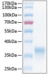 Recombinant Human HCVADR/CXADR Protein (RP00970)