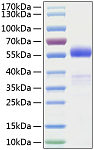 Recombinant Human Frizzled-1/FZD1 Protein (RP00971)