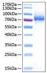 Recombinant Human IL-7RA/CD127 Protein (RP00976)