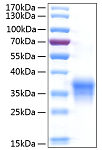 Recombinant Human IFN-lambda 1/IL-29 Protein (RP00977)