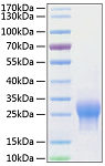 Recombinant Human ALK-1/ACVRL1 Protein (RP00978)