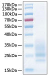 Recombinant Human CD83 Protein (RP00983)
