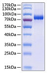Recombinant Human EphA3 Protein (RP00985)