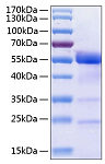 Recombinant Human Osteopontin/SPP-1 Protein (RP00989)