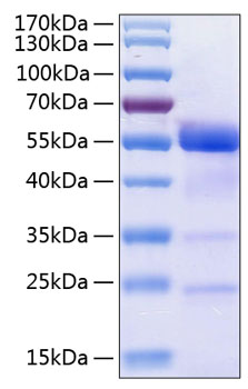 Recombinant Human Osteopontin/SPP-1 Protein