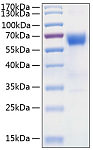 Recombinant Human TNFRSF10D/DcR2/TRAIL-R4/CD264 Protein (RP00992)