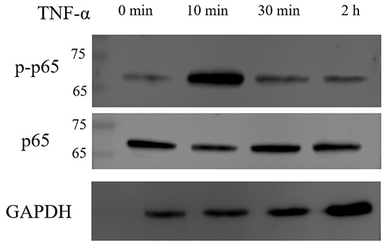 Recombinant Human TNF-alpha Protein