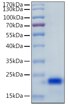 Active Recombinant Human IL-4 Protein