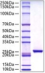 Recombinant Human C-Reactive Protein/CRP Protein (RP01019)