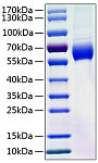Recombinant Human Angiotensinogen/AGT Protein (RP01021)