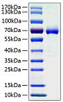 Recombinant Human Ephrin-A3/EFNA3 Protein (RP01022)