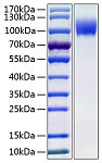 Recombinant Human IL-13RA1/CD213a1 Protein (RP01025)