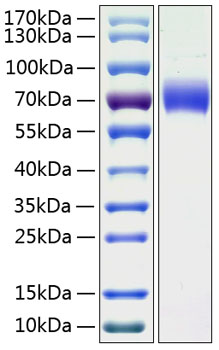 Recombinant Human Kininogen-1/KNG1 Protein