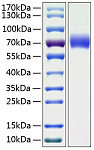 Recombinant Human Kininogen-1/KNG1 Protein (RP01026)