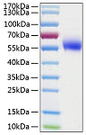 Recombinant Human IL-1R2/IL-1RT2/CD121b Protein (RP01028)