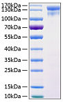 Recombinant Human EGFR Protein (RP01029)