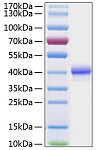 Recombinant Human EGF Protein (RP01030)