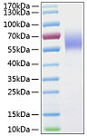 Recombinant Human IL-13RA1/CD213a1 Protein (RP01032)