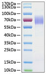 Recombinant Human MSR1/CD204 Protein (RP01033)