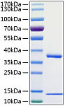 Recombinant Human FcRn Protein (RP01037)