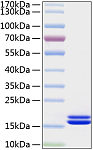 Active Recombinant Human IL-2 Protein (RP01039)