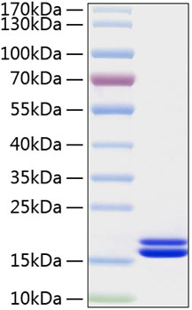 Active Recombinant Human IL-2 Protein