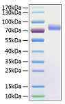 Recombinant Human Fc-gamma RIII alpha/CD16a Protein (RP01043)