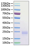 Recombinant Human CTLA-4/CD152 Protein (RP01044)