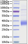 Recombinant Human TROP-2/TACSTD2 Protein (RP01048)