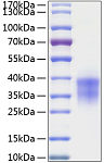 Recombinant Human TWSG1 Protein (RP01049)