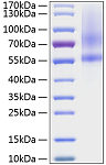 Recombinant Human Testican-1/SPOCK1 Protein (RP01051)