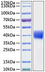Recombinant Human Mesothelin/MSLN Protein (RP01053)