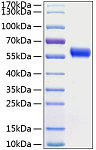 Recombinant Human Frizzled-5/FZD5 Protein (RP01057)