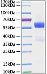 Active Recombinant Mouse Flt3 ligand/Flt3L Protein (RP01058)